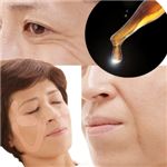 リンクルラミネート　目尻用・ほうれい線用セット