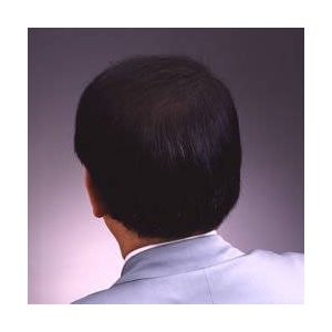 【新型インフルエンザ対応】ウイルス対策総合セット（N99マスク×10枚 ゴーグル×1個 天然ゴム手袋×10枚）