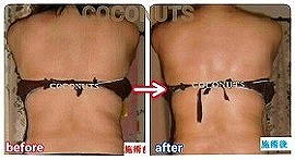 豊橋　ココナッツ　【肋骨矯正】　くびれ　ダイエット.jpg
