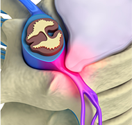 herunia-characteristic-img01-1