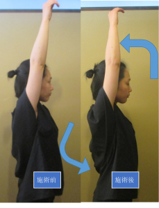 神谷　肩甲骨剥がし